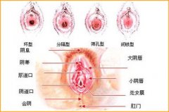 濮阳做处女膜修复手术哪个医院好