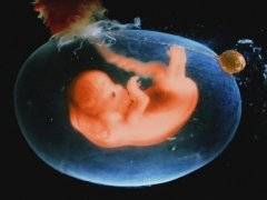 顺产好还是剖腹产好