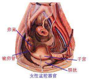 盆腔炎会导致不孕吗