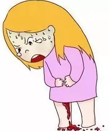 女性早孕流产症状